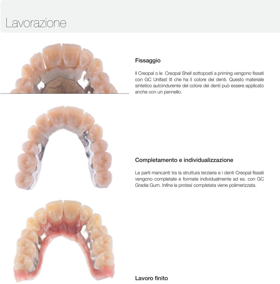 Questo materiale sintetico autoindurente del colore dei denti può essere applicato anche con un pennello.