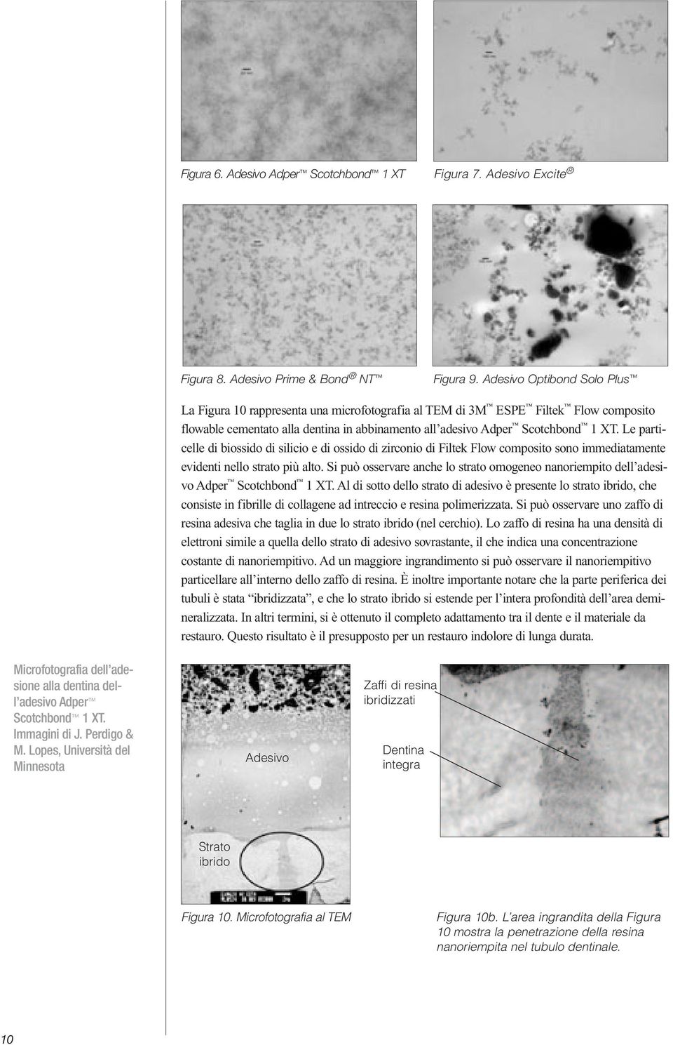 Le particelle di biossido di silicio e di ossido di zirconio di Filtek Flow composito sono immediatamente evidenti nello strato più alto.