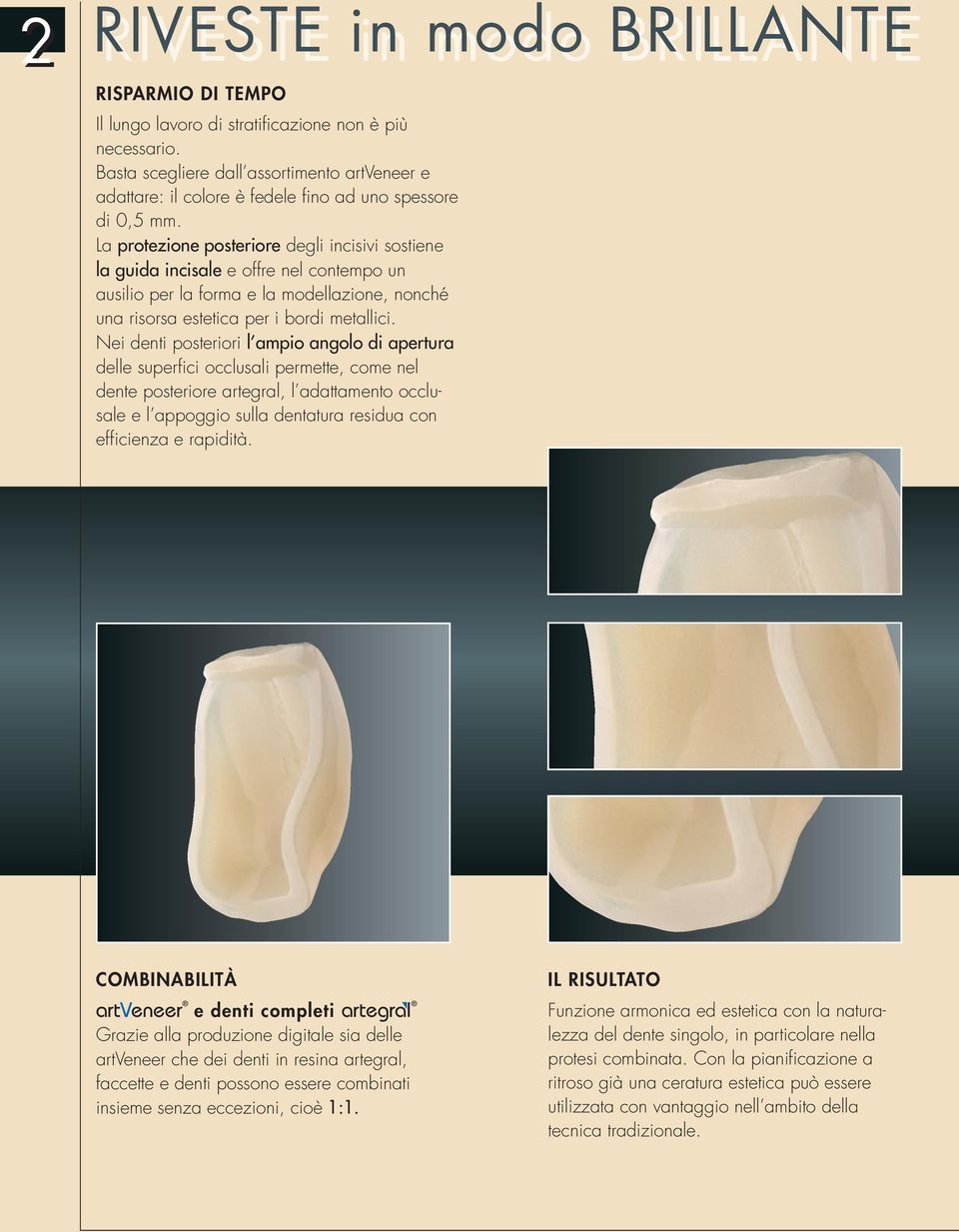 La protezione posteriore degli incisivi sostiene la guida incisale e offre nel contempo un ausilio per la forma e la modellazione, nonché una risorsa estetica per i bordi metallici.