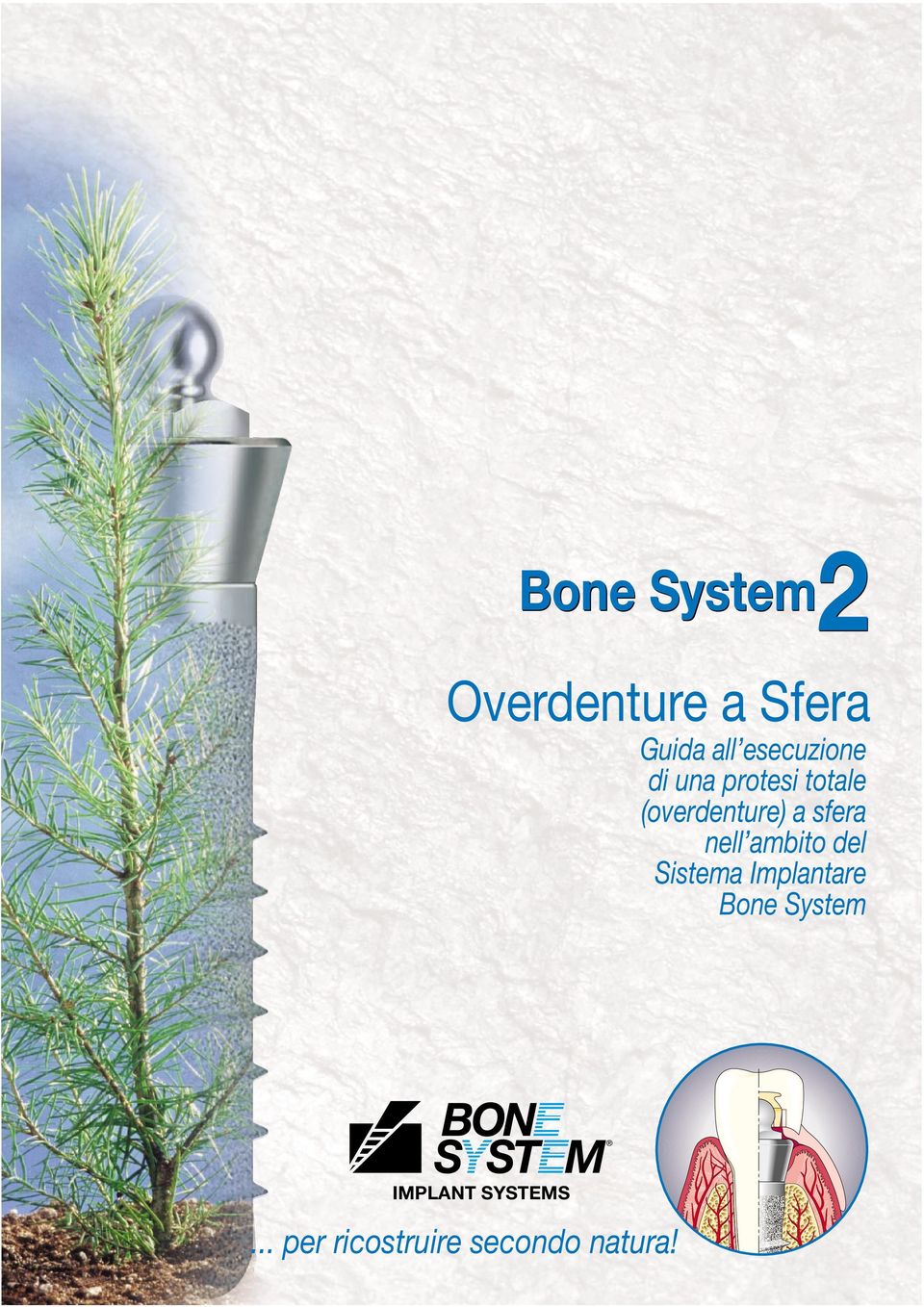 sfera nell ambito del Sistema Implantare Bone