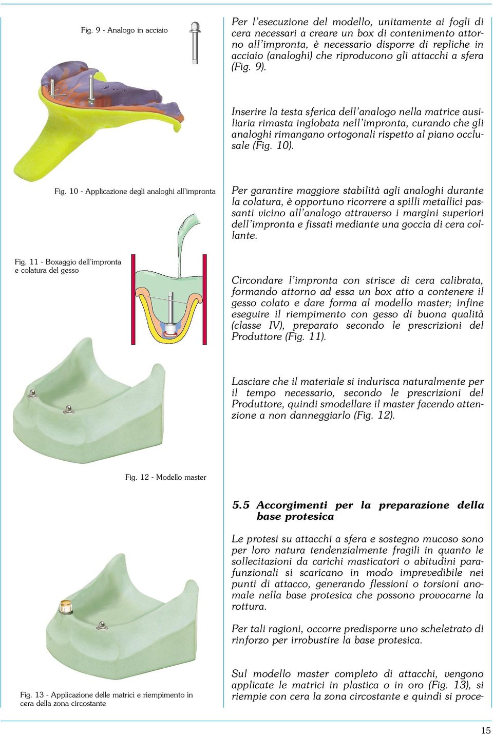 Inserire la testa sferica dell analogo nella matrice ausiliaria rimasta inglobata nell impronta, curando che gli analoghi rimangano ortogonali rispetto al piano occlusale (Fig. 10). Fig.