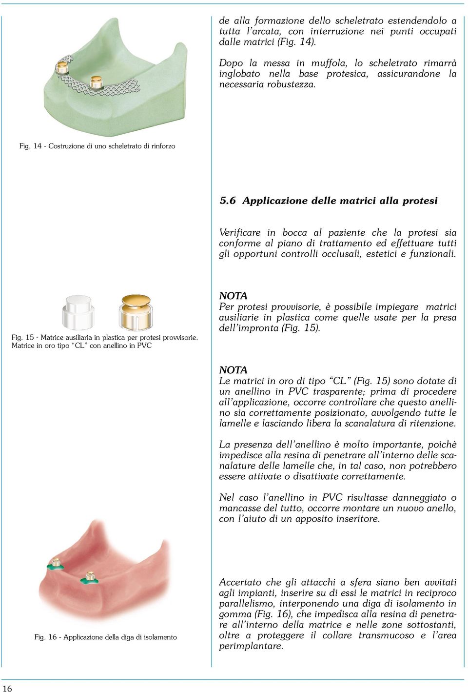 6 Applicazione delle matrici alla protesi Verificare in bocca al paziente che la protesi sia conforme al piano di trattamento ed effettuare tutti gli opportuni controlli occlusali, estetici e