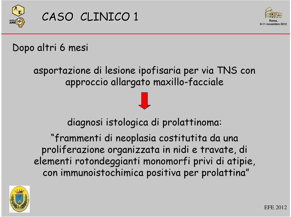 neoplasia costitutita da una proliferazione organizzata in nidi e travate, di elementi