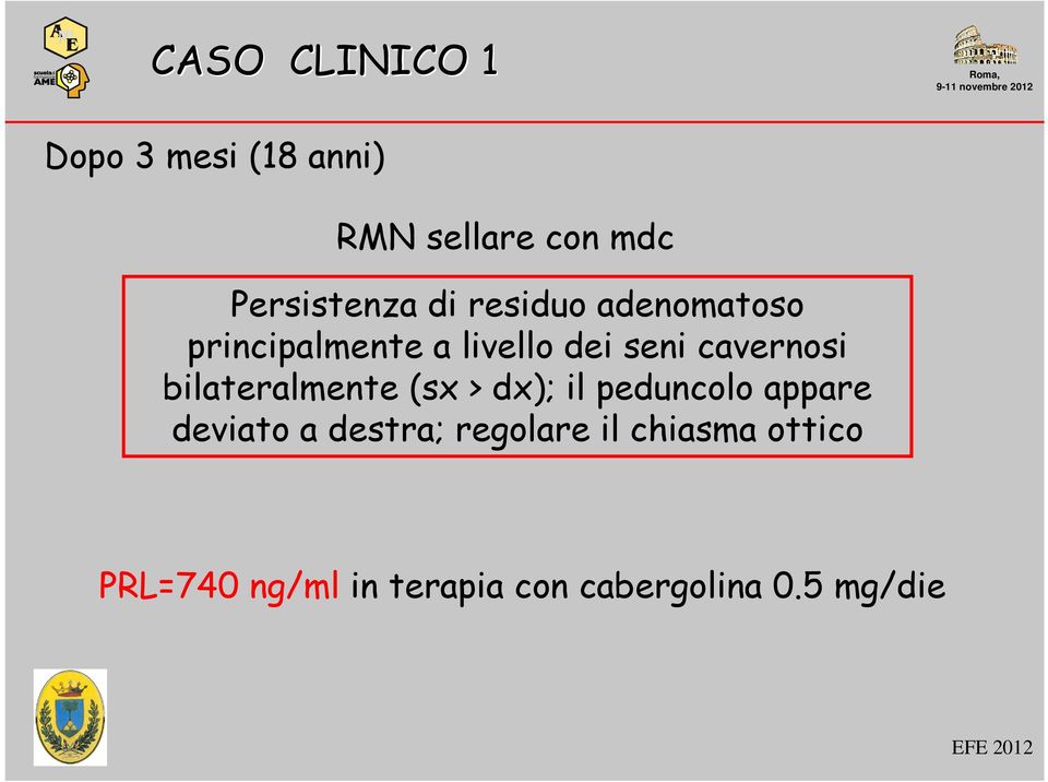 bilateralmente (sx > dx); il peduncolo appare deviato a destra;