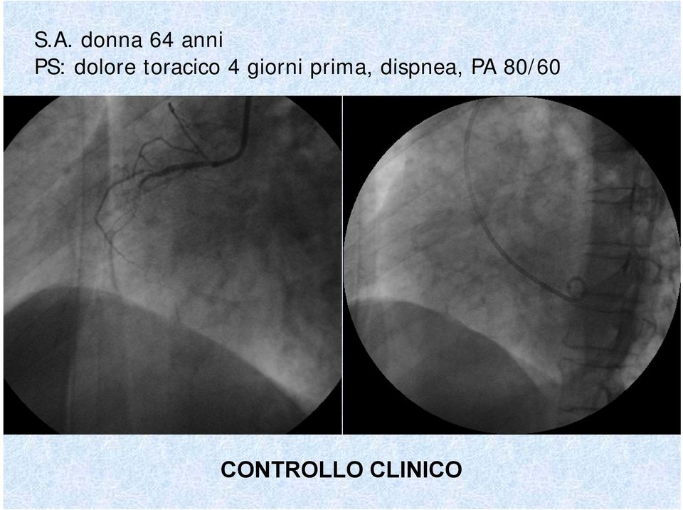 giorni prima, dispnea,