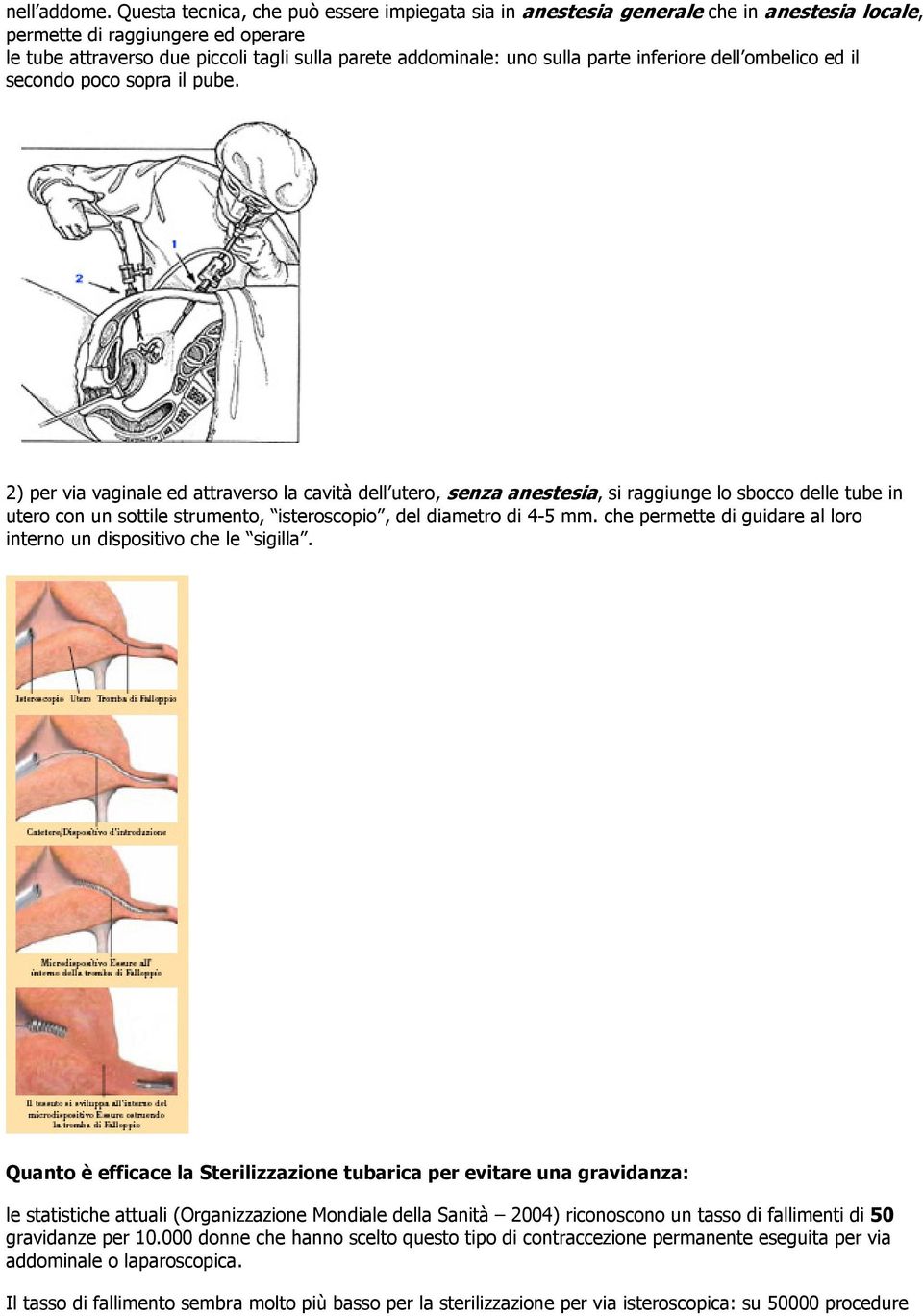 parte inferiore dell ombelico ed il secondo poco sopra il pube.