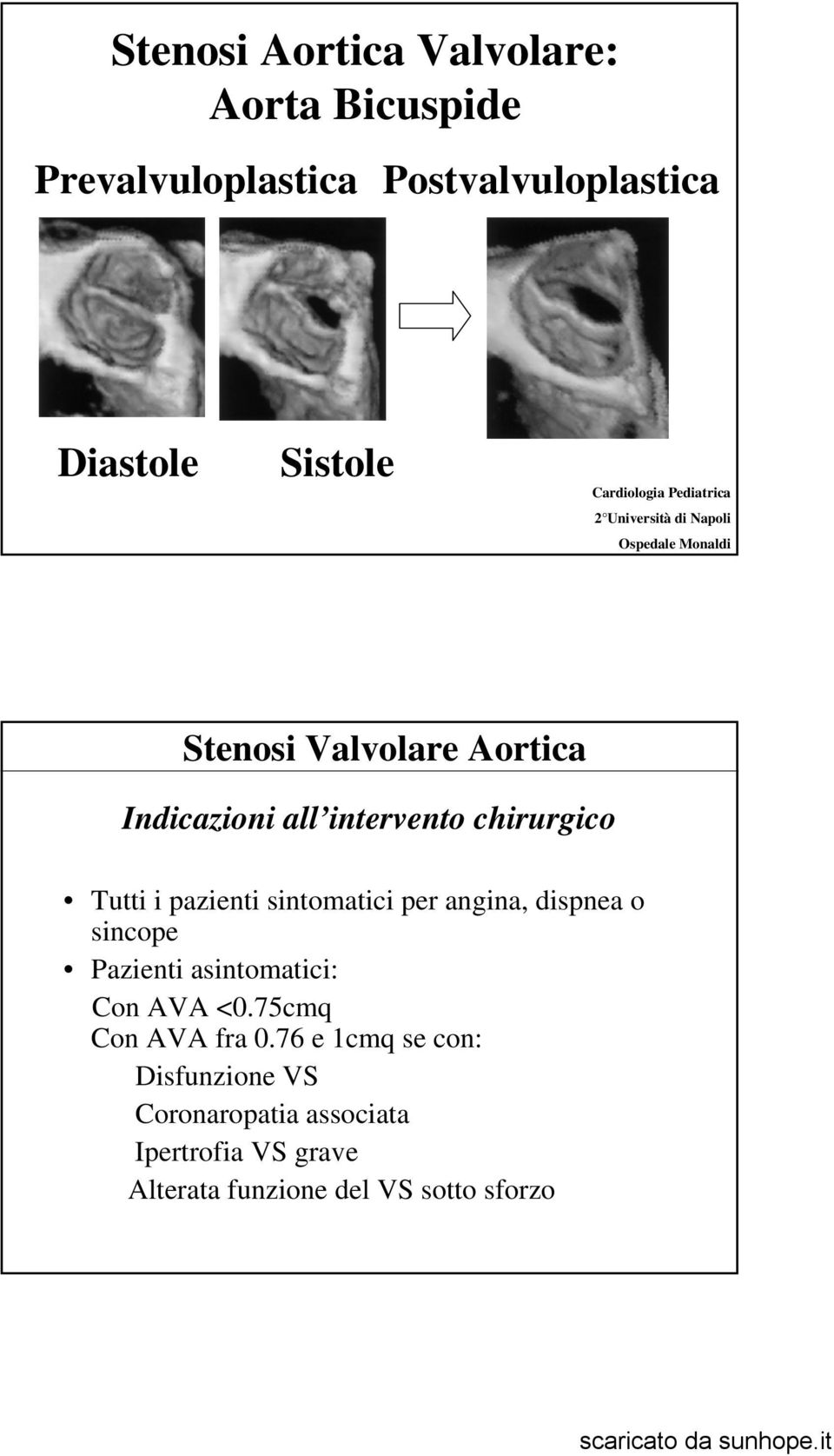 chirurgico Tutti i pazienti sintomatici per angina, dispnea o sincope Pazienti asintomatici: Con AVA <0.