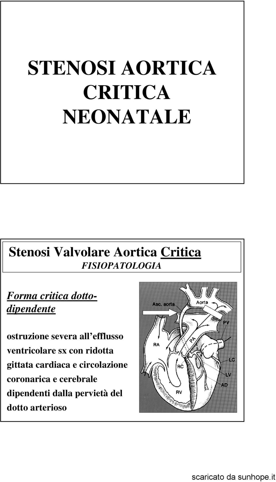 efflusso ventricolare sx con ridotta gittata cardiaca e