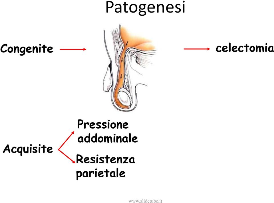 Pressione addominale