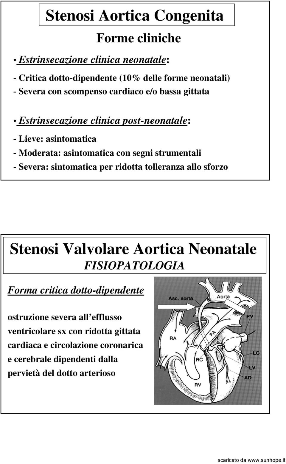 - Severa: sintomatica per ridotta tolleranza allo sforzo Stenosi Valvolare Aortica Neonatale FISIOPATOLOGIA Forma critica dotto-dipendente