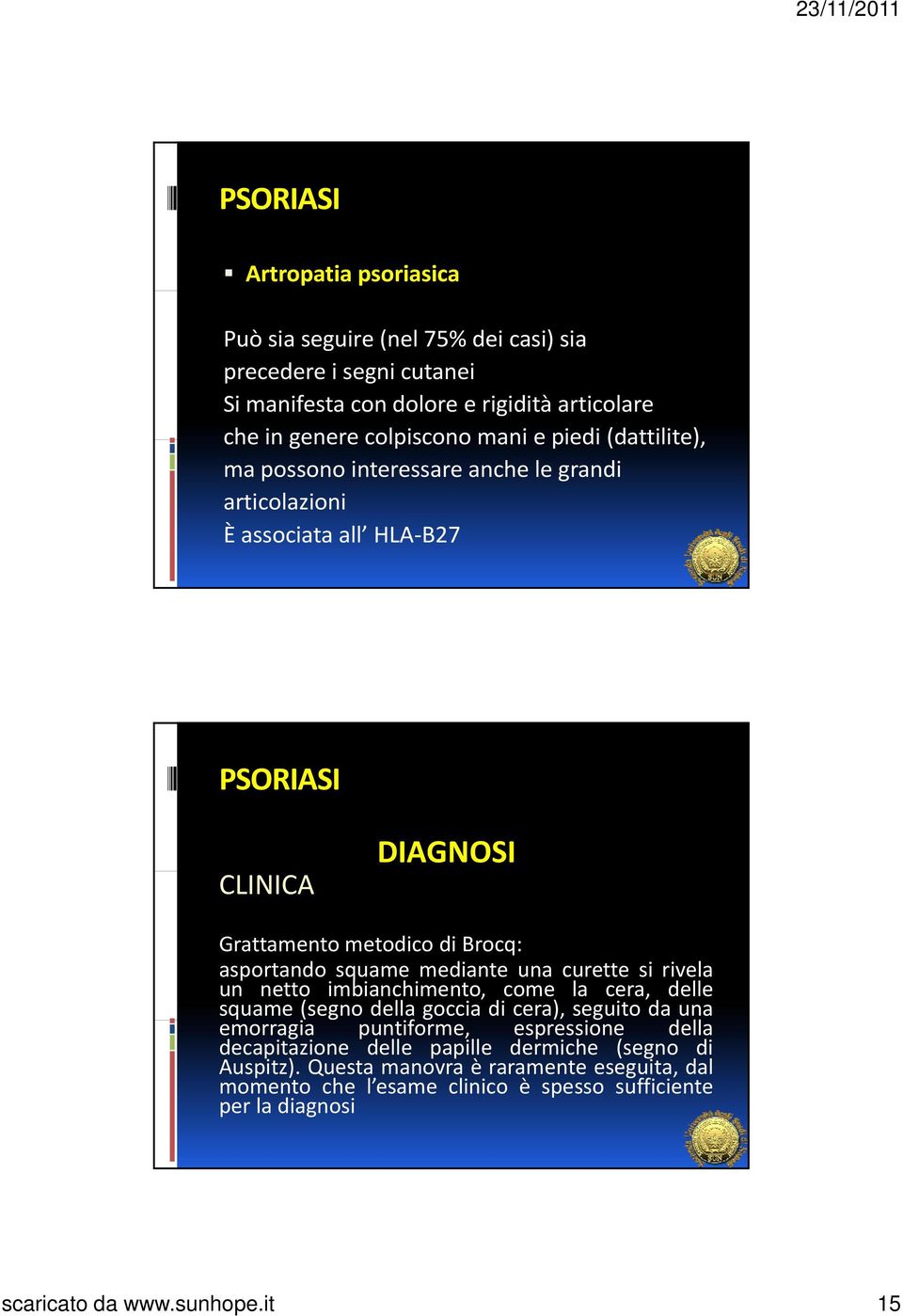 curette si rivela un netto imbianchimento, come la cera, delle squame (segno della goccia di cera), seguito da una emorragia puntiforme, espressione dll della decapitazione