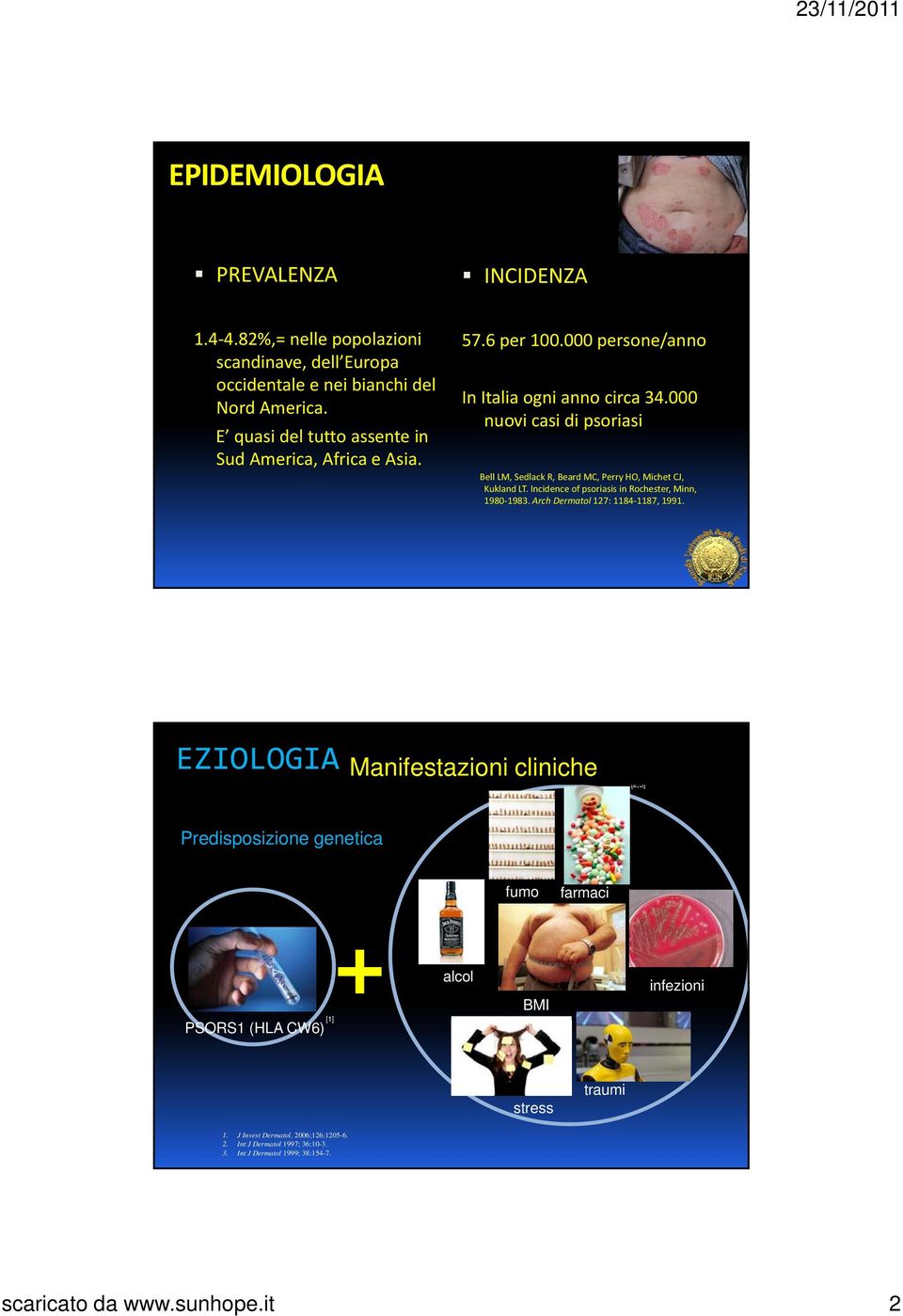 000 nuovi casi di psoriasi Bell LM, Sedlack R, Beard MC, Perry HO, Michet CJ, Kukland LT. Incidence of psoriasis in Rochester, Minn, 1980 1983. Arch Dermatol 127: 1184 1187, 1991.