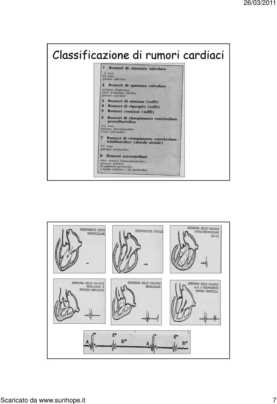 cardiaci