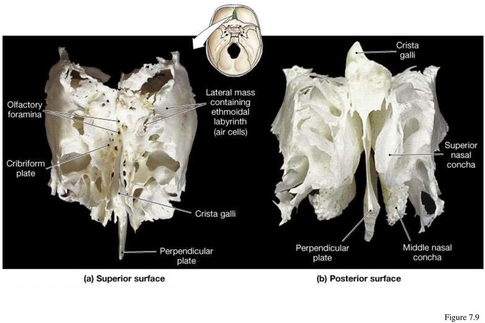 Ethmoid 9