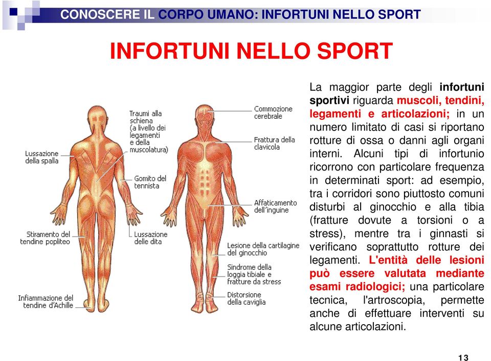 Alcuni tipi di infortunio ricorrono con particolare frequenza in determinati sport: ad esempio, tra i corridori sono piuttosto comuni disturbi al ginocchio e alla tibia (fratture