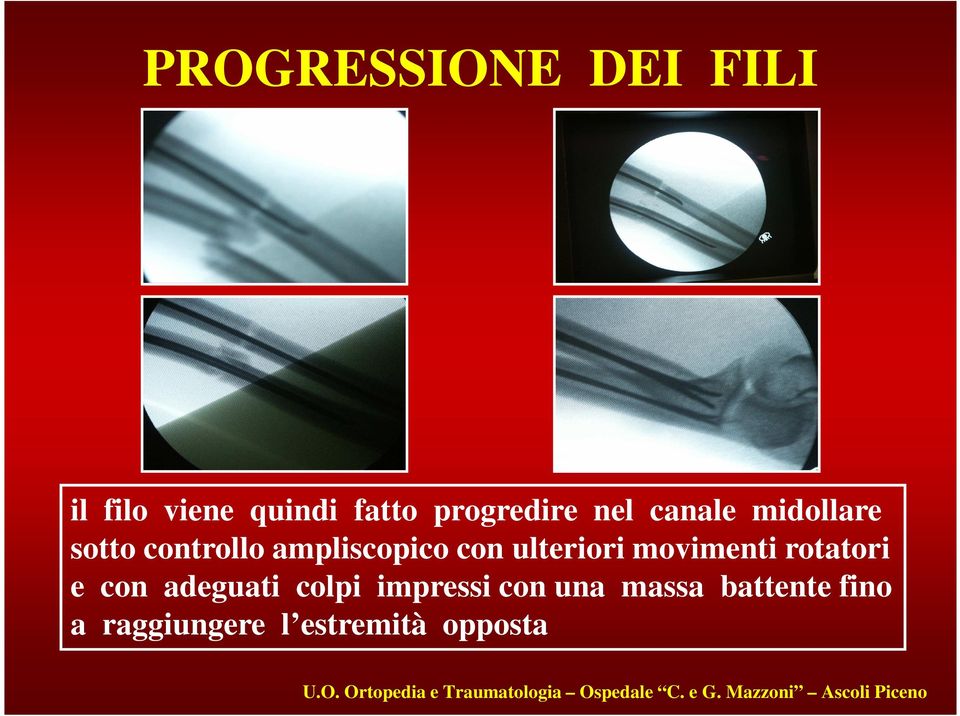 ampliscopico con ulteriori movimenti rotatori e con