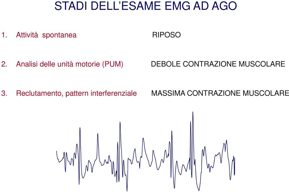 Analisi delle unità motorie (PUM) DEBOLE