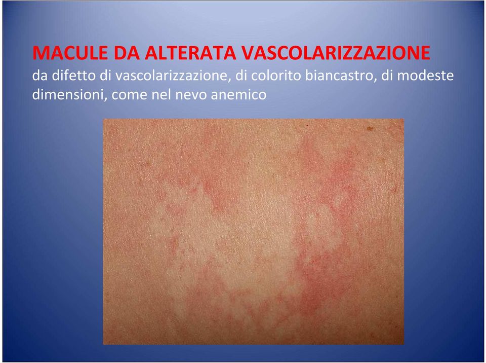 vascolarizzazione, di colorito