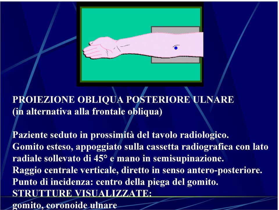 Gomito esteso, appoggiato sulla cassetta radiografica con lato radiale sollevato di 45 e mano in