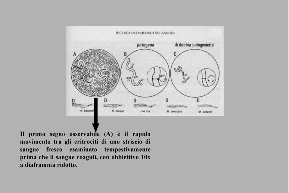 sangue fresco esaminato tempestivamente prima che