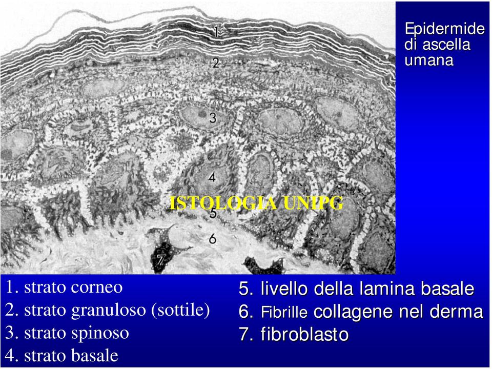 strato basale 5. livello della lamina basale 6.