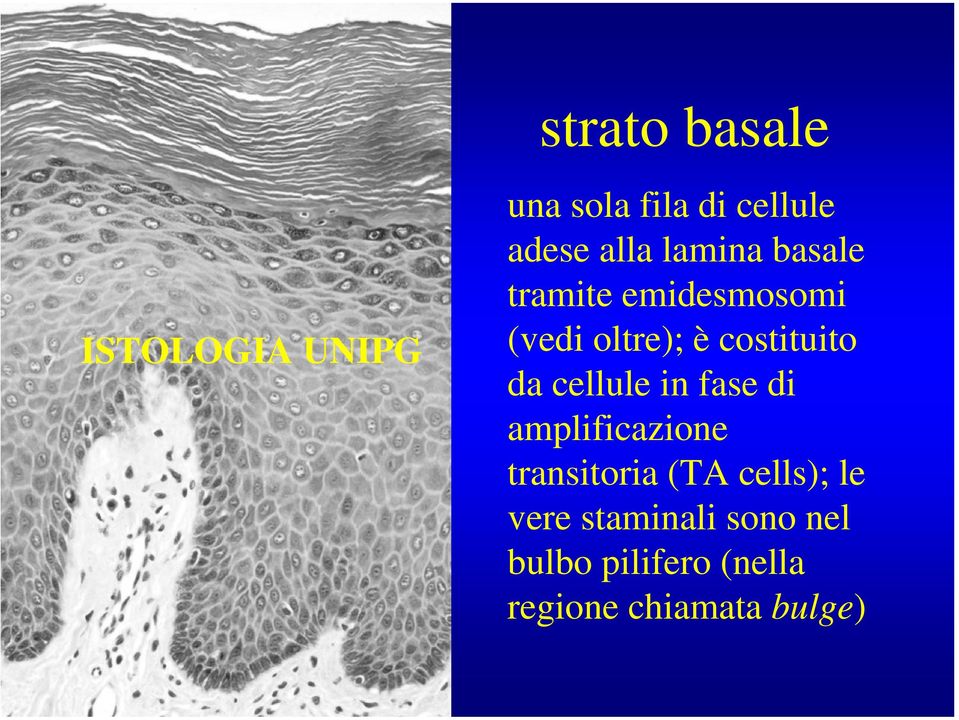 cellule in fase di amplificazione transitoria (TA cells); le