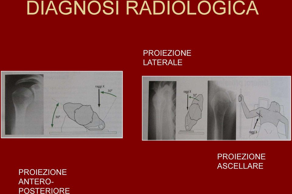 PROIEZIONE ANTERO-