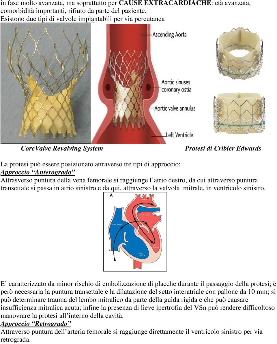 Anterogrado Attrasverso puntura della vena femorale si raggiunge l atrio destro, da cui attraverso puntura transettale si passa in atrio sinistro e da qui, attraverso la valvola mitrale, in