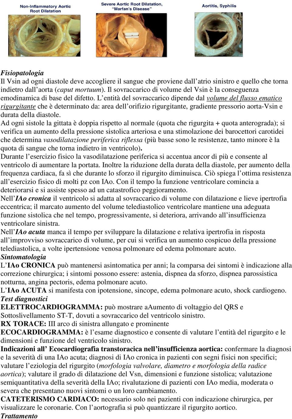 L entità del sovraccarico dipende dal volume del flusso ematico rigurgitante che è determinato da: area dell orifizio rigurgitante, gradiente pressorio aorta-vsin e durata della diastole.