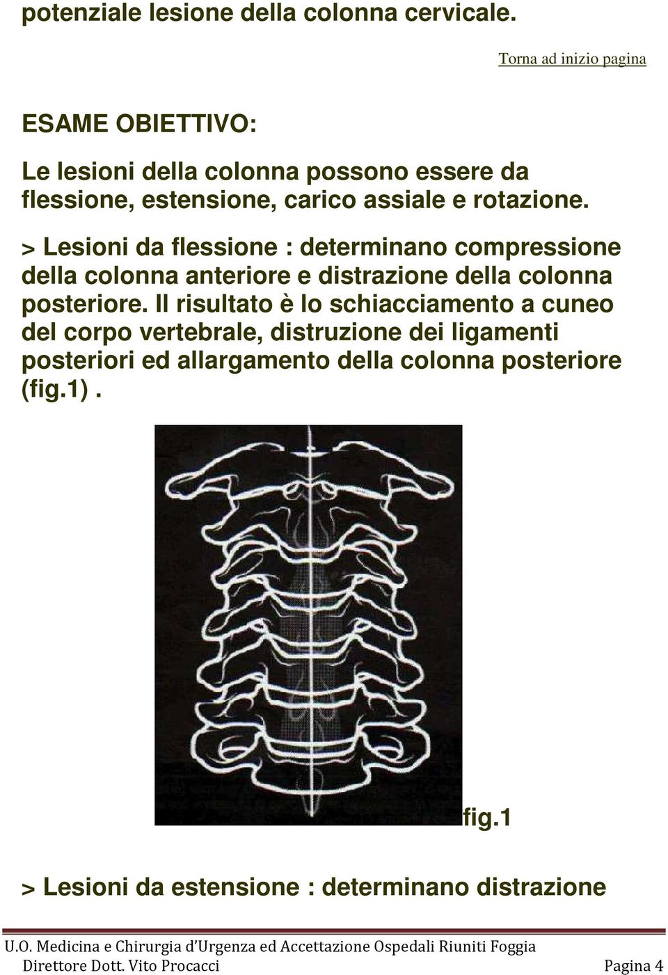 > Lesioni da flessione : determinano compressione della colonna anteriore e distrazione della colonna posteriore.