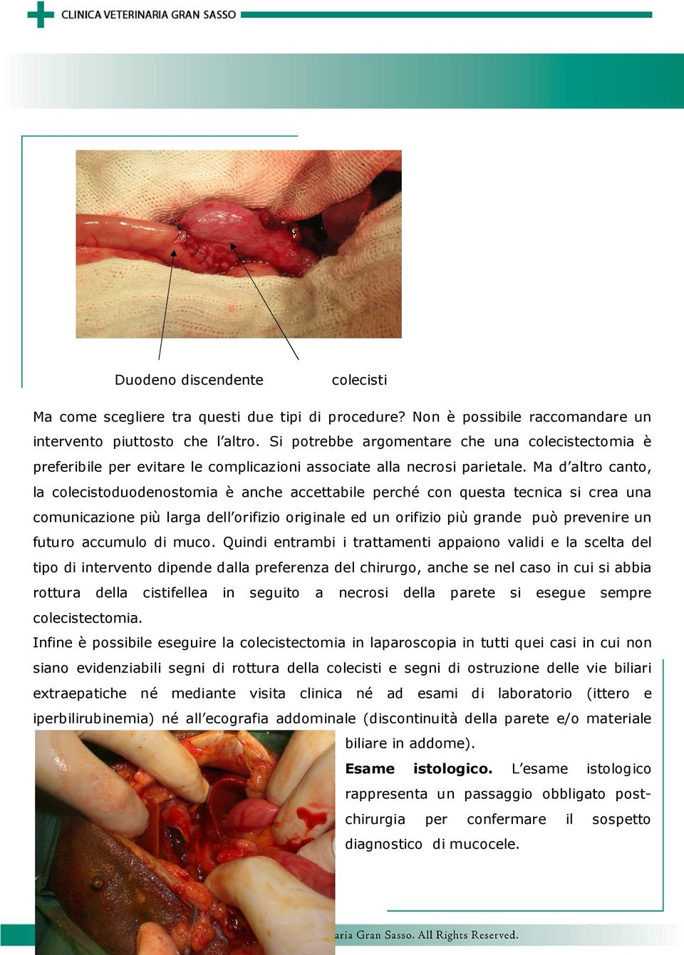 Ma d altro canto, la colecistoduodenostomia è anche accettabile perché con questa tecnica si crea una comunicazione più larga dell orifizio originale ed un orifizio più grande può prevenire un futuro