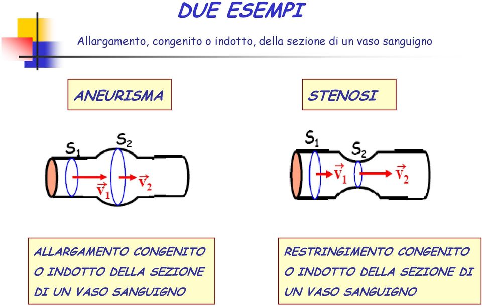 ALLARGAMENTO CONGENITO O INDOTTO DELLA SEZIONE DI UN VASO