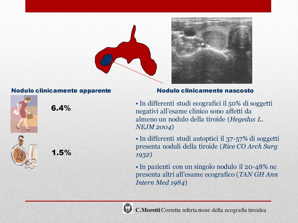 sono affetti da almeno un nodulo della tiroide (Hegedus L.