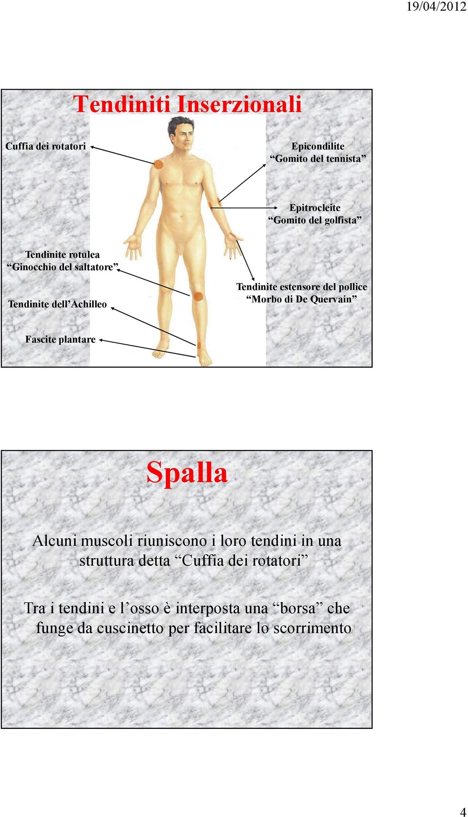 Quervain Fascite plantare Spalla Alcuni muscoli riuniscono i loro tendini in una struttura detta Cuffia dei