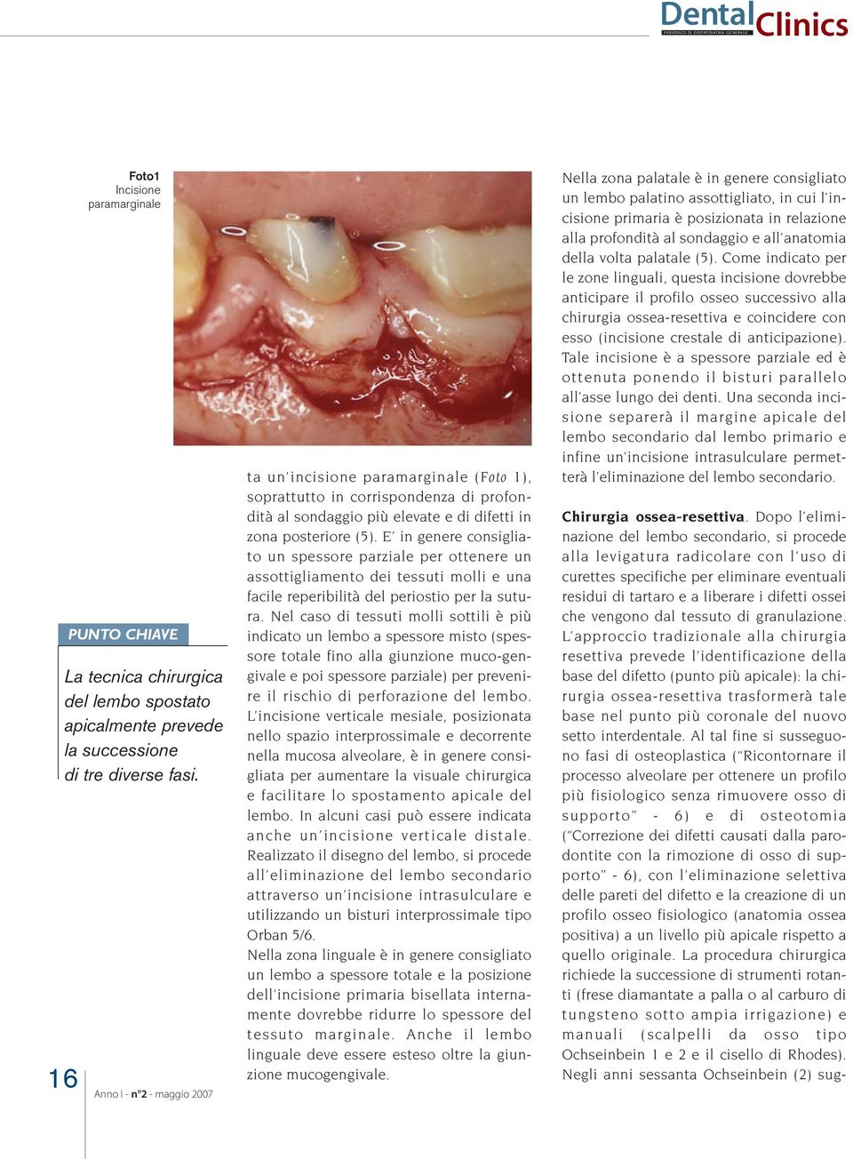 E in genere consigliato un spessore parziale per ottenere un assottigliamento dei tessuti molli e una facile reperibilità del periostio per la sutura.