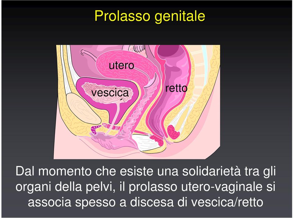 organi della pelvi, il prolasso