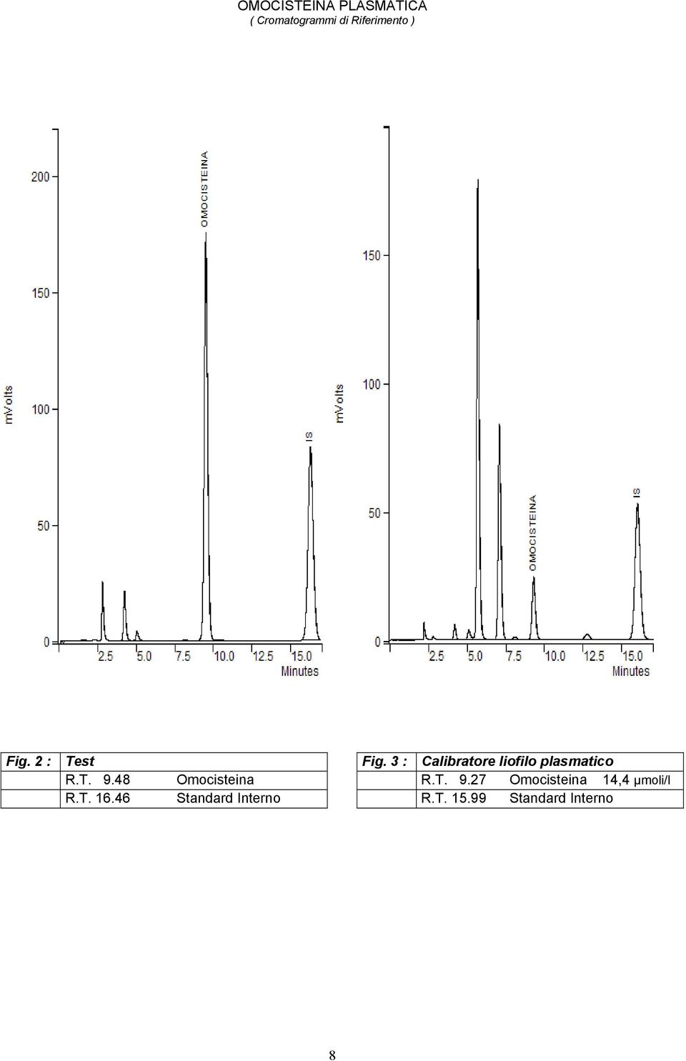 T. 9.48 Omocisteina R.T. 9.27 Omocisteina 14,4 µmoli/l R.