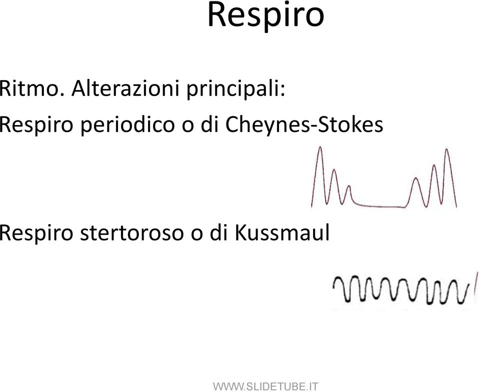 Respiro periodico o di