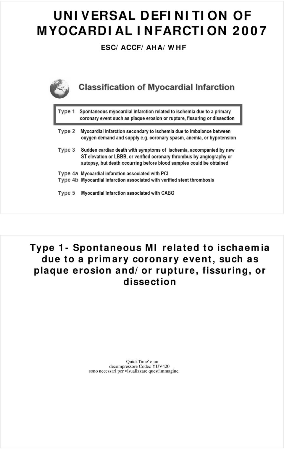 such as plaque erosion and/or rupture, fissuring, or dissection QuickTimeª