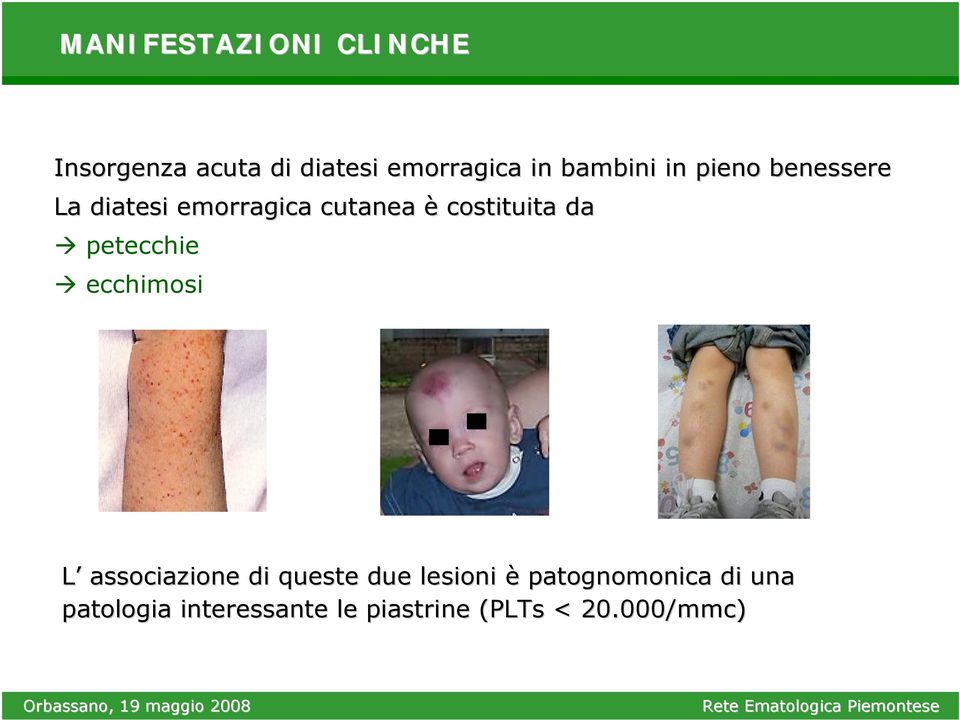 costituita da petecchie ecchimosi L associazione di queste due lesioni