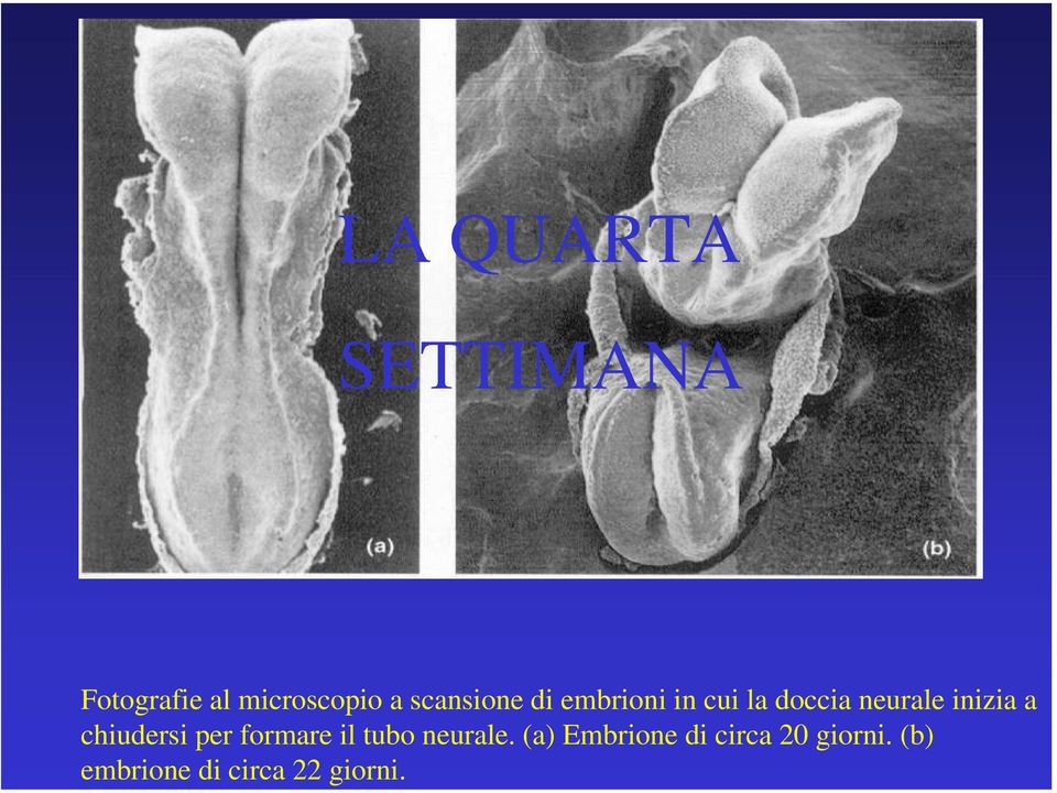 formare il tubo neurale.