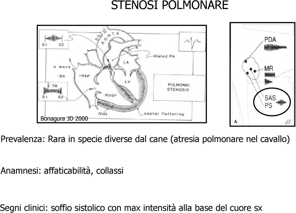 cavallo) Anamnesi: affaticabilità, collassi Segni