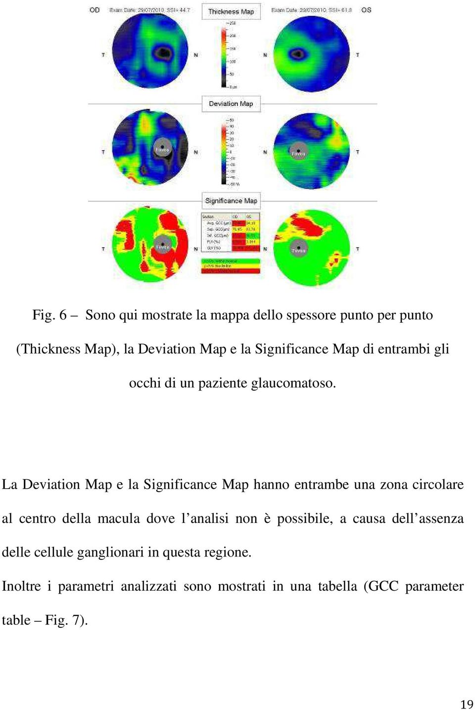 La Deviation Map e la Significance Map hanno entrambe una zona circolare al centro della macula dove l analisi non