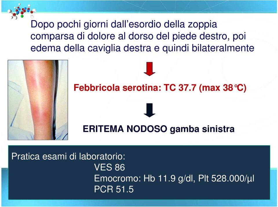 Febbricola serotina: TC 37.
