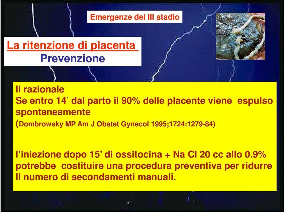 Gynecol 1995;1724:1279-84) l iniezione dopo 15 di ossitocina + Na Cl 20 cc allo 0.