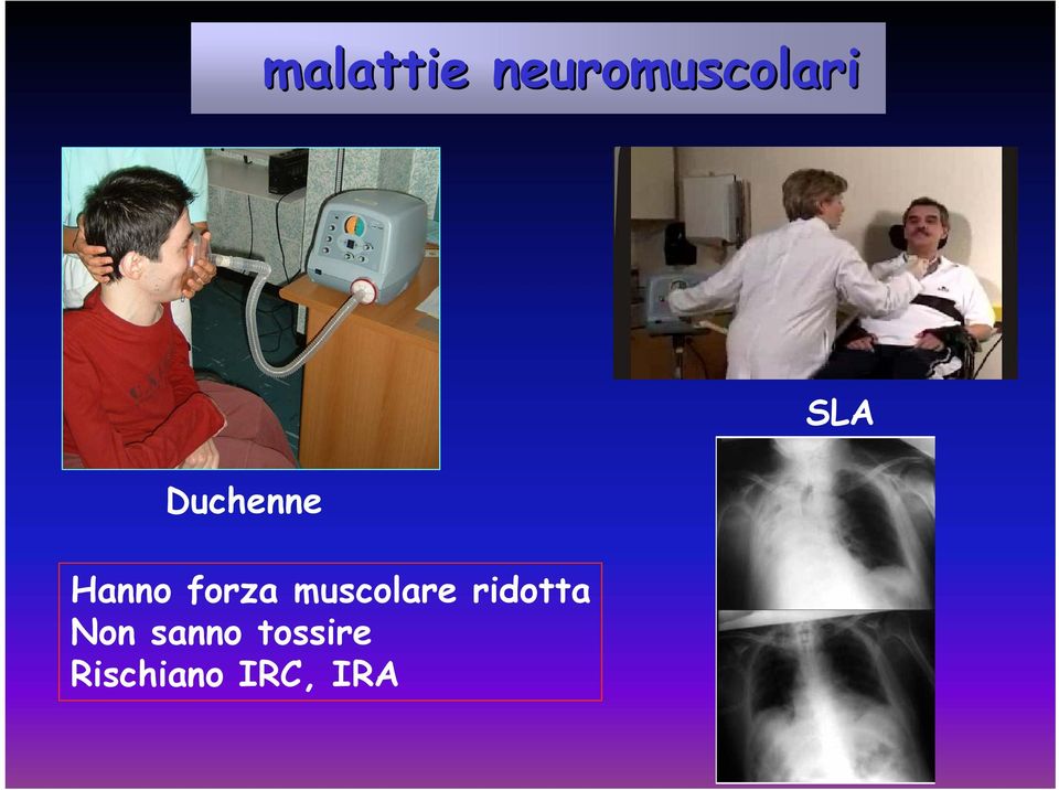 muscolare ridotta Non