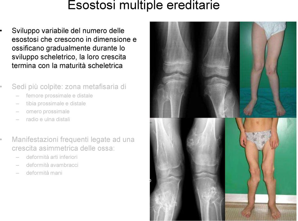 zona metafisaria di femore prossimale e distale tibia prossimale e distale omero prossimale radio e ulna distali