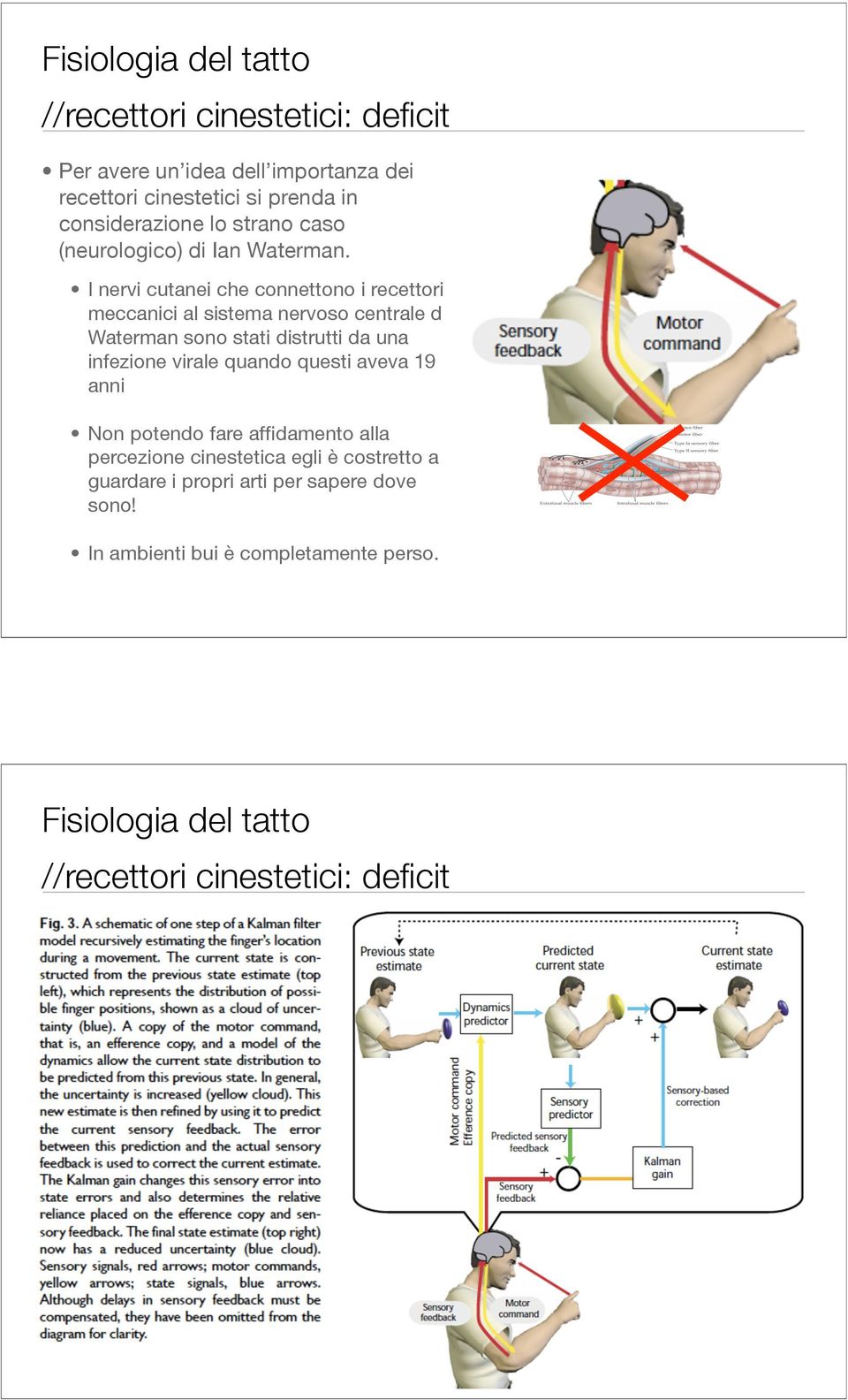 I nervi cutanei che connettono i recettori meccanici al sistema nervoso centrale di Waterman sono stati distrutti da una infezione virale