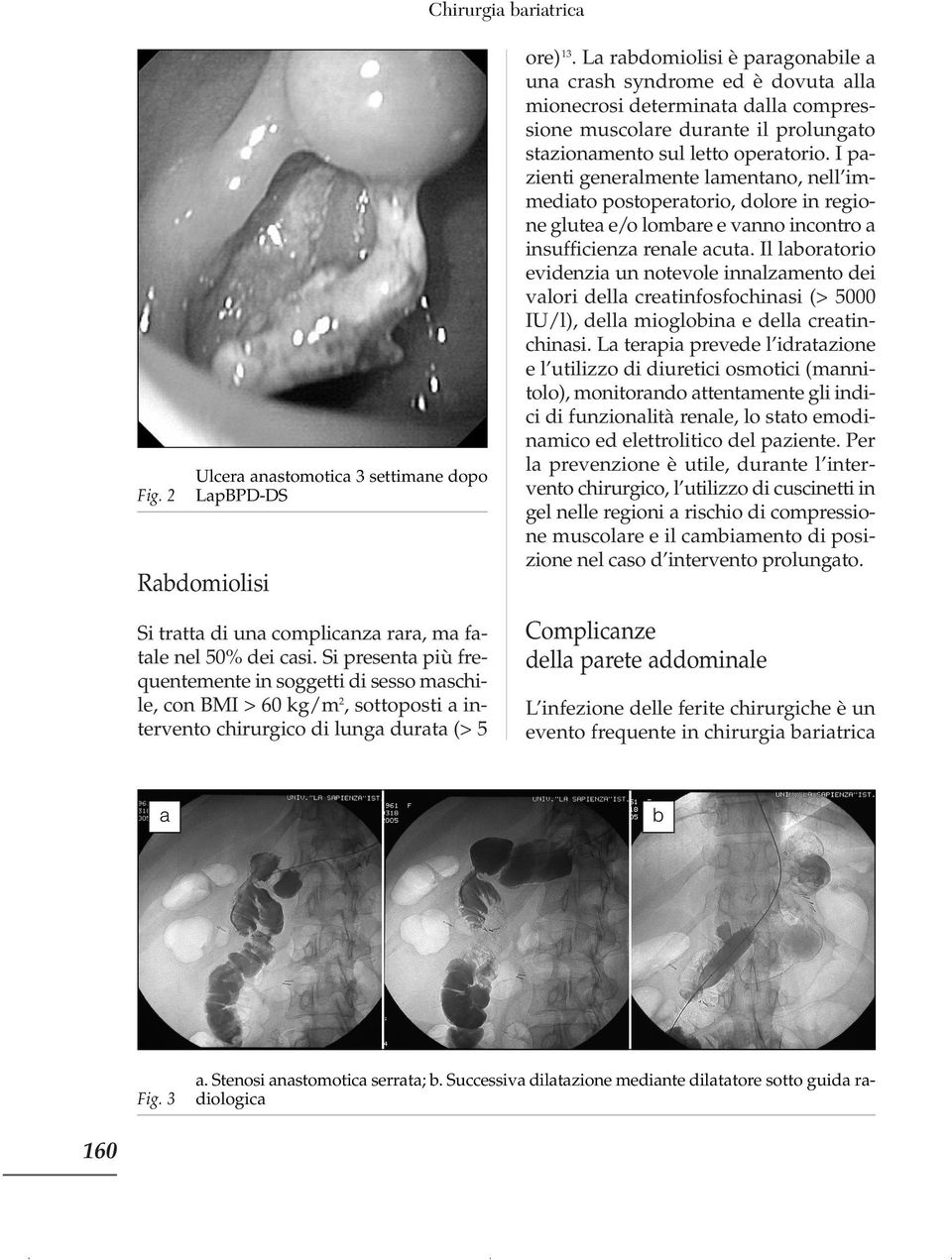 I pazienti generalmente lamentano, nell immediato postoperatorio, dolore in regione glutea e/o lombare e vanno incontro a insufficienza renale acuta.