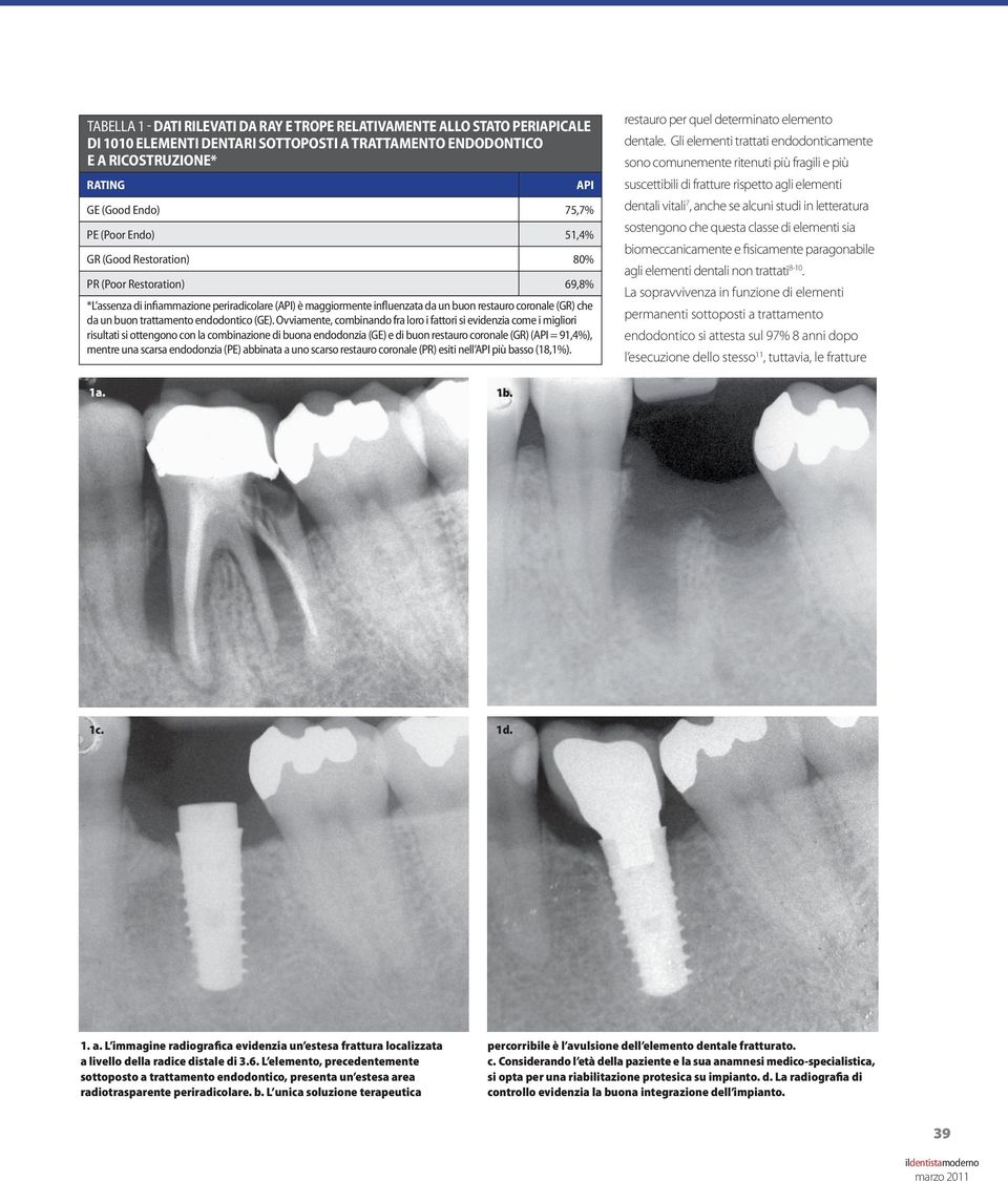 trattamento endodontico (GE).